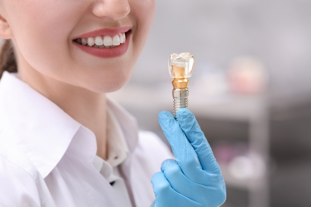 dental implants near me